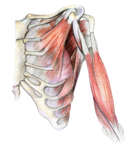 Atrioventricular Fistula