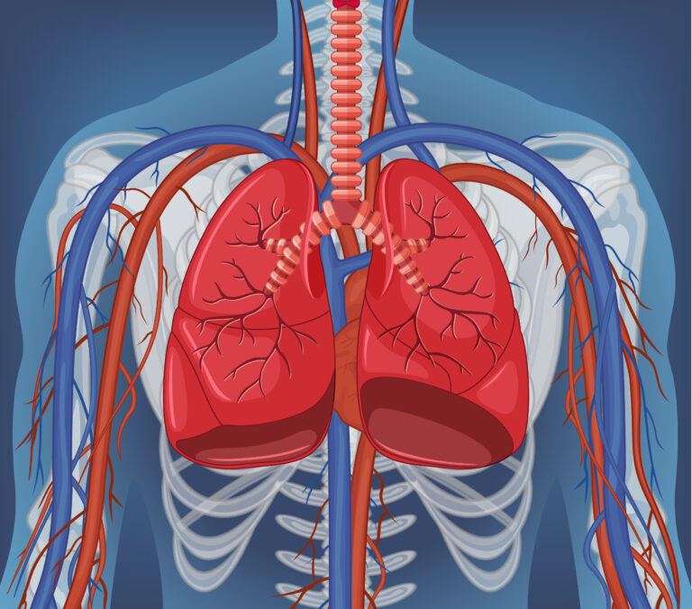 Total Anomalous Pulmonary Venous Connection (TAPVC) Surgery