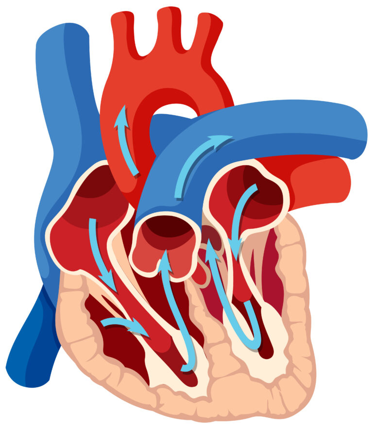 Aortic Valve repair