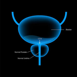 Anorectal Manometry